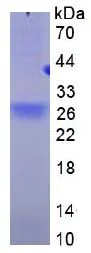 SDS-PAGE - Recombinant Human BCMA protein (His tag) (AB270592)