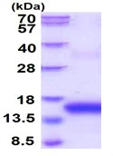 SDS-PAGE - Recombinant Human BCMA protein (His tag N-Terminus) (AB139210)