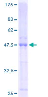 SDS-PAGE - Recombinant Human BCMA protein (Tagged) (AB132007)