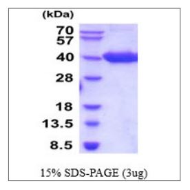 SDS-PAGE - Recombinant Human BCMA protein (Tagged) (AB270571), expandable thumbnail