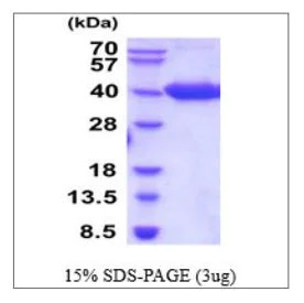 SDS-PAGE - Recombinant Human BCMA protein (Tagged) (AB270571)
