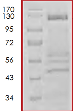 SDS-PAGE - Recombinant Human Bcr protein (AB72493), expandable thumbnail