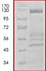 SDS-PAGE - Recombinant Human Bcr protein (AB72493)