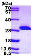 SDS-PAGE - Recombinant Human BDH2 protein (His tag N-Terminus) (AB103058)