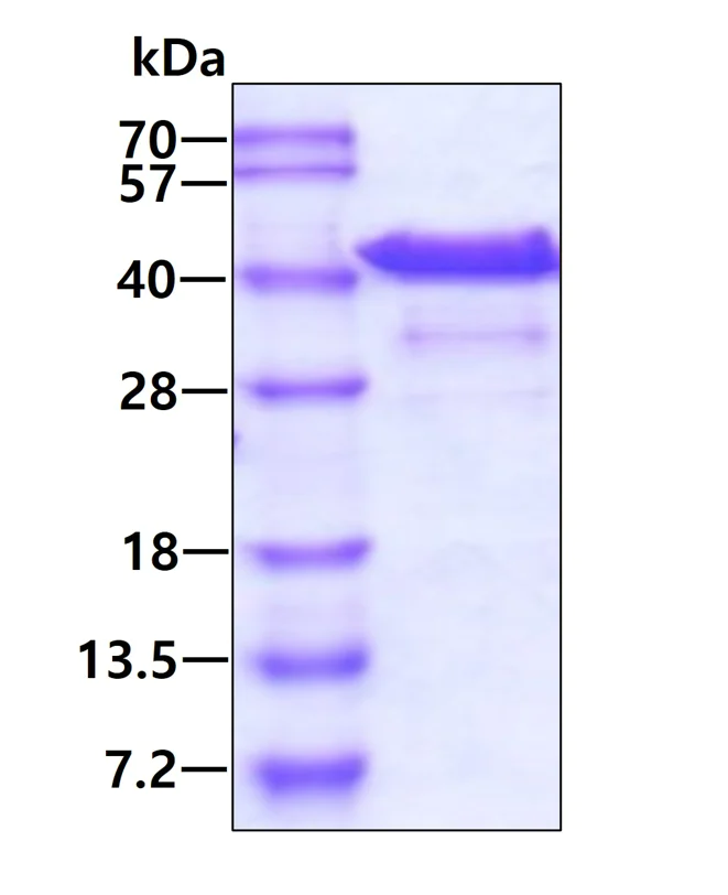SDS-PAGE - Recombinant Human Bestrophin/BEST1 protein (denatured) (AB177633)