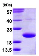 SDS-PAGE - Recombinant Human BET3 protein (AB124564)