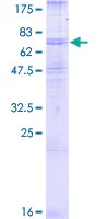SDS-PAGE - Recombinant Human beta 2 Adrenergic Receptor protein (AB157862)