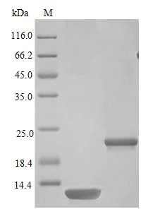 SDS-PAGE - Recombinant human beta 2 Defensin/BD-2 protein (Active) (AB243124)