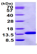 SDS-PAGE - Recombinant Human beta 2 Microglobulin protein (AB98116), expandable thumbnail