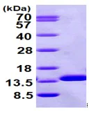 SDS-PAGE - Recombinant Human beta 2 Microglobulin protein (His tag N-Terminus) (AB98116)