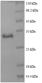 SDS-PAGE - Recombinant Human beta Actin protein (His tag) (AB240844)