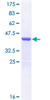 SDS-PAGE - Recombinant Human beta-cardiac myosin heavy chain protein (GST tag N-Terminus) (AB112326)