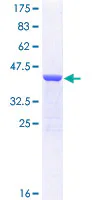SDS-PAGE - Recombinant Human beta-cardiac myosin heavy chain protein (GST tag N-Terminus) (AB112326)