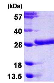 SDS-PAGE - Recombinant Human beta Casein protein (AB123168)