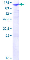 Recombinant Human beta Catenin protein