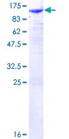 SDS-PAGE - Recombinant Human beta Catenin protein (GST tag N-Terminus) (AB158230)