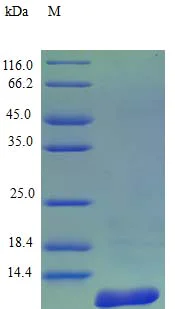 SDS-PAGE - Recombinant human beta Defensin 1 protein (Active) (AB243114)