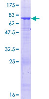 SDS-PAGE - Recombinant Human beta I Tubulin protein (AB164310), expandable thumbnail