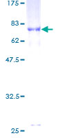 SDS-PAGE - Recombinant Human beta II Tubulin protein (AB160968), expandable thumbnail