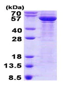 SDS-PAGE - Recombinant Human beta III Tubulin protein (AB140581)