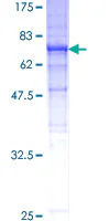 SDS-PAGE - Recombinant Human beta III Tubulin protein (GST tag N-Terminus) (AB131995)