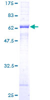 SDS-PAGE - Recombinant Human beta Sarcoglycan protein (AB152676)