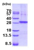 SDS-PAGE - Recombinant Human beta Sarcoglycan protein (AB202169)