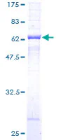 SDS-PAGE - Recombinant Human beta Sarcoglycan protein (GST tag N-Terminus) (AB152676)