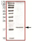 SDS-PAGE - Recombinant Human beta Synuclein protein (AB140415)