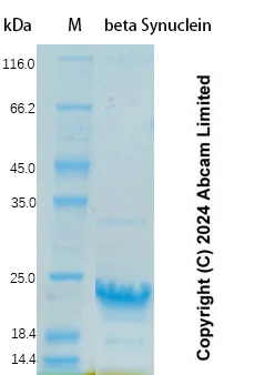 SDS-PAGE - Recombinant Human beta Synuclein Protein Standard (His tag) (AB323097)