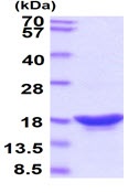 SDS-PAGE - Recombinant Human beta Synuclein protein (AB48853)