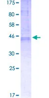 SDS-PAGE - Recombinant Human BI-1 protein (GST tag N-Terminus) (AB152736)