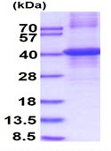 SDS-PAGE - Recombinant Human Biglycan protein (denatured) (AB140579), expandable thumbnail