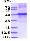 SDS-PAGE - Recombinant Human Biglycan protein (denatured) (His tag N-Terminus) (AB140579)