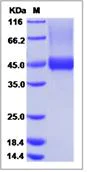 SDS-PAGE - Recombinant Human Biglycan protein (His tag) (AB276271)