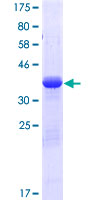 SDS-PAGE - Recombinant Human Bim protein (GST tag N-Terminus) (AB112387)