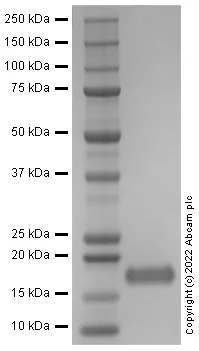 SDS-PAGE - Recombinant Human BIRC5 Protein (AB290057)