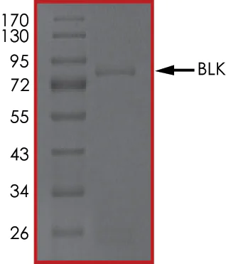 SDS-PAGE - Recombinant human BLK protein (AB60876)
