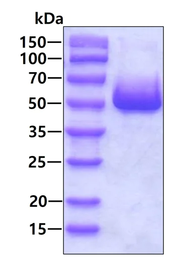 SDS-PAGE - Recombinant Human BLMH protein (His tag N-Terminus) (AB101205)