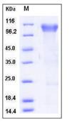SDS-PAGE - Recombinant Human BLNK protein (His tag) (AB276489)