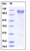 SDS-PAGE - Recombinant Human BLNK protein (His tag) (AB276489)