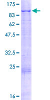 SDS-PAGE - Recombinant Human Blood Group Kell Antigen protein (AB116891)