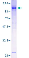 SDS-PAGE - Recombinant Human BMAL1 protein (AB131888)