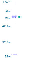 Recombinant Human Bmi1 protein