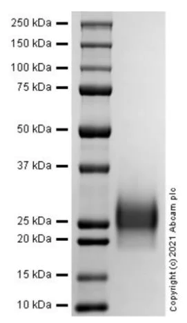 SDS-PAGE - Recombinant Human BMPR1A protein (AB288805)