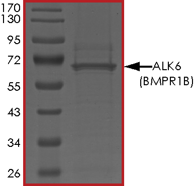 SDS-PAGE - Recombinant human BMPR1B protein (AB107949), expandable thumbnail