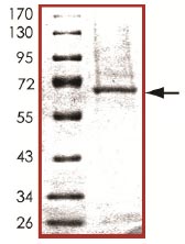 SDS-PAGE - Recombinant human BMPR1B protein (AB107949), expandable thumbnail