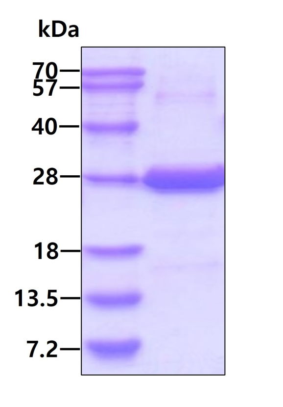 SDS-PAGE - Recombinant Human BNIP1 protein (denatured) (AB202216)