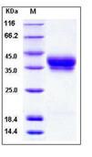SDS-PAGE - Recombinant Human Bone marrow stromal cell antigen 1 protein (His tag) (AB276196)