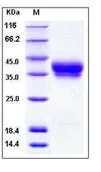 SDS-PAGE - Recombinant Human Bone marrow stromal cell antigen 1 protein (His tag) (AB276196)